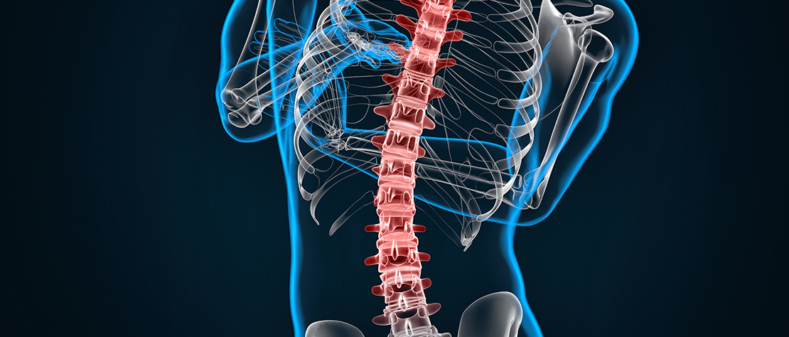 Spine image for scoliosis treatment in Singapore